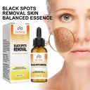 Essence sửa chữa melanin da OUHOE, làm sáng và sửa chữa da, loại bỏ làm tối và đốm tối, cấp nước