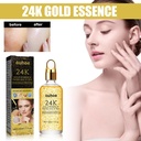 Essence mặt OUHOE 24k, se lỗ chân lông, cung cấp độ ẩm và làm sáng da, tinh chất làm săn chắc và phục hồi