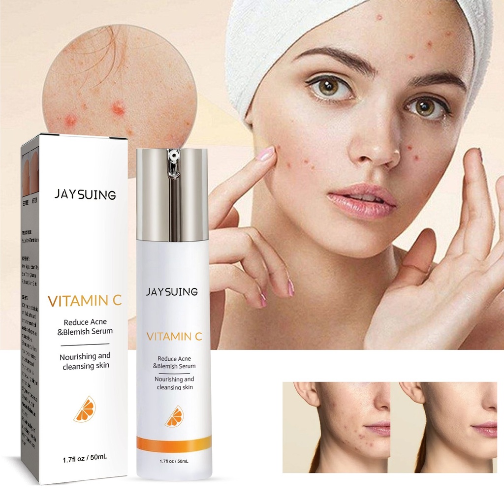 Serum Ngừa Mụn Và Trị Mụn Jayusing, Giảm Mụn Và Vết Thâm Mụn Dưỡng Ẩm Serum Sửa Chữa Da