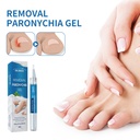 OUHOE Gel Sửa Chữa Móng Màu Xám, Sửa Chữa Móng Ngón Tay, Thicken Nail Care Bút Sơn Móng Màu Xám