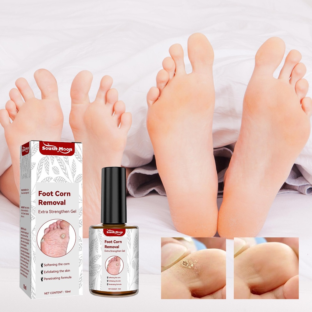 Gel loại bỏ mụn cóc chân South Moon, giãn nở thêm, sửa chữa da sạch mụn cóc chân và ngón tay