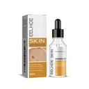 Serum chống mụn EELHOE, Làm sạch sâu cho da mịn màng, Làm mờ mụn tay, chân và nốt mụn