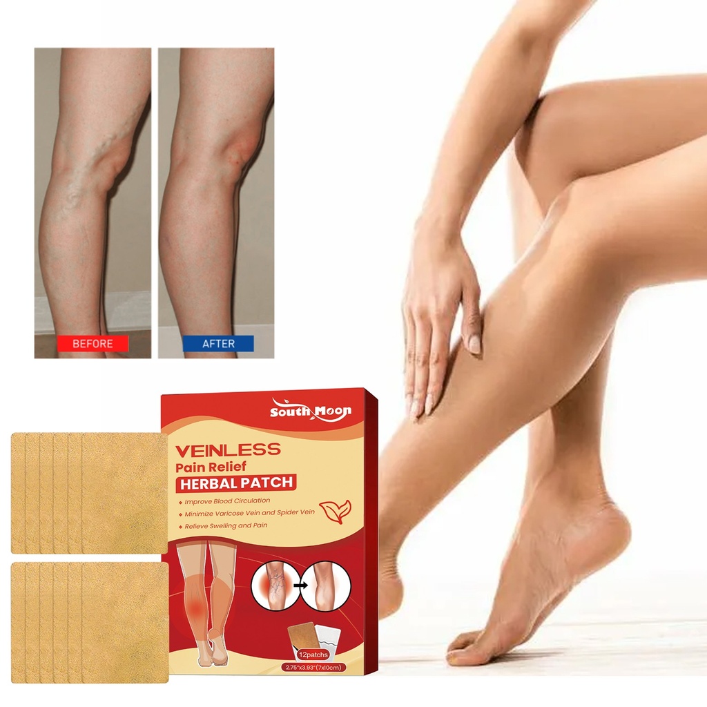 Băng dán thảo dược giảm đau tĩnh mạch South Moon, Massage chân giảm đau, Băng chăm sóc tĩnh mạch giun đất