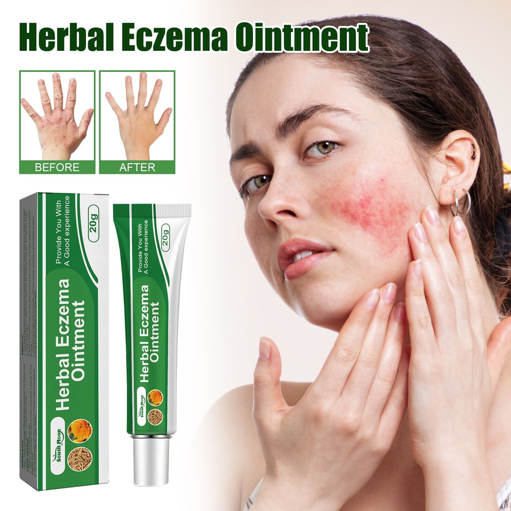 Thuốc mỡ eczema thảo dược South Moon, giảm đỏ da, ngứa và sửa chữa da tay chân