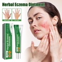 Thuốc mỡ eczema thảo dược South Moon, giảm đỏ da, ngứa và sửa chữa da tay chân