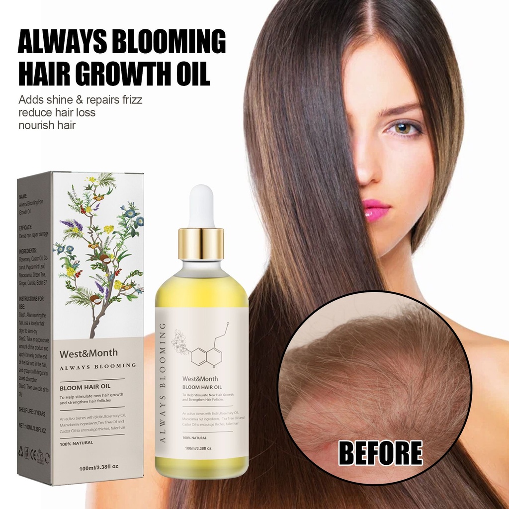 Dầu kích thích mọc tóc West&Month Always Blooming, cung cấp độ ẩm và làm dày tóc, sửa chữa tóc hư tổn, khô và xơ xác