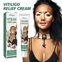 Kem Giảm Triệu Chứng Vitiligo South Moon, Sửa Chữa Vết Trắng Và Vết Nâu Trên Da