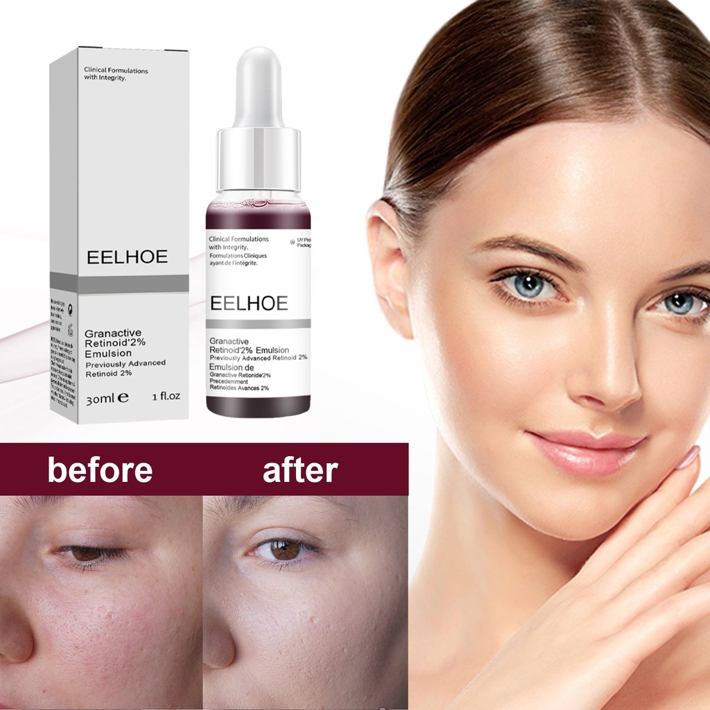 EELHOE Tinh chất Acid Salicylic, Làm mịn nếp nhăn Hydrating Chất lỏng chăm sóc Axit trái cây