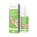 Serum Sửa Chữa Móng Ximonth, Móng Tay và Chân Móng Xám, Móng Mềm, Móng Sáng, Móng Dày Sạch