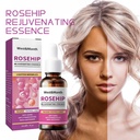 Essence tái tạo hoa hồng West&Month, Cung cấp độ ẩm và làm săn chắc da, Làm sáng vết thâm và nếp nhăn