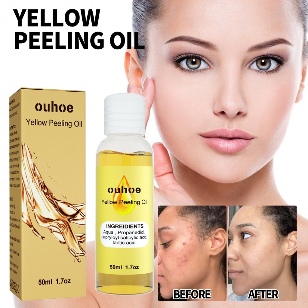 Dầu Tẩy Tế Bào Chết Làm Sáng Da OUHOE, Làm Sạch Da Chết, Làm Nhạt Nám Da, Chăm Sóc Da Sáng