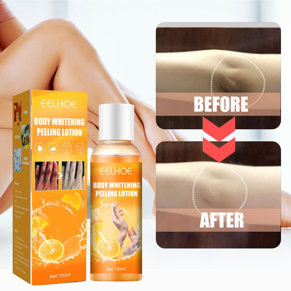 EELHOE Gel làm trắng đen, sửa chữa và làm trắng da, loại bỏ melanin