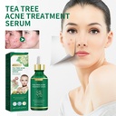 Serum Trà Xanh Chống Mụn Jaysuing, Giảm Thiểu Đốm Mụn Nhạy Cảm Trên Mặt, Serum Dưỡng Ẩm Làm Sạch Mụn
