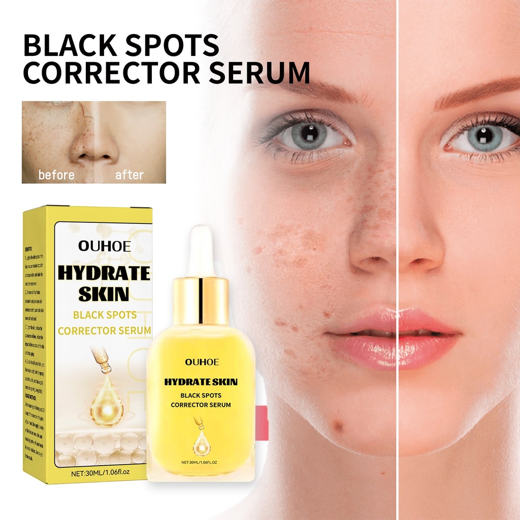 Tinh Chất Chỉnh Sửa Vết Sạm Da OUHOE, Giảm Vết Thâm Và Nếp Nhăn Trên Mặt, Dưỡng Ẩm, Làm Sáng Và Trắng Da