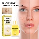 Tinh Chất Chỉnh Sửa Vết Sạm Da OUHOE, Giảm Vết Thâm Và Nếp Nhăn Trên Mặt, Dưỡng Ẩm, Làm Sáng Và Trắng Da