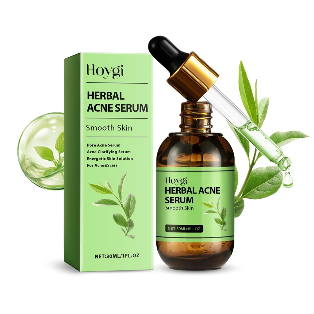 Serum trị mụn kế thừa Hoygi, Giảm mụn trứng cá với kem dưỡng ẩm toàn diện