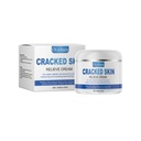 OceAura Dưỡng Ẩm Tay Chân Cung Cấp Độ Ẩm Cho Khuỷu Tay, Massage Gót Chân, Chăm Sóc Chân Và Da