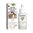 OUHOE Essence Mặt Làm Sáng Các Đốm và Vết Thâm Mụn, Cung Cấp Độ Ẩm Cho Da, Essence Chăm Sóc Da Hàng Ngày