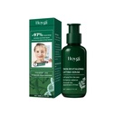 Hoygi Essence Làm Săn Chắc, Dưỡng Ẩm, Cấp Nước Và Làm Mềm Da, Giảm Nếp Nhăn Nhỏ Trên Khuôn Mặt