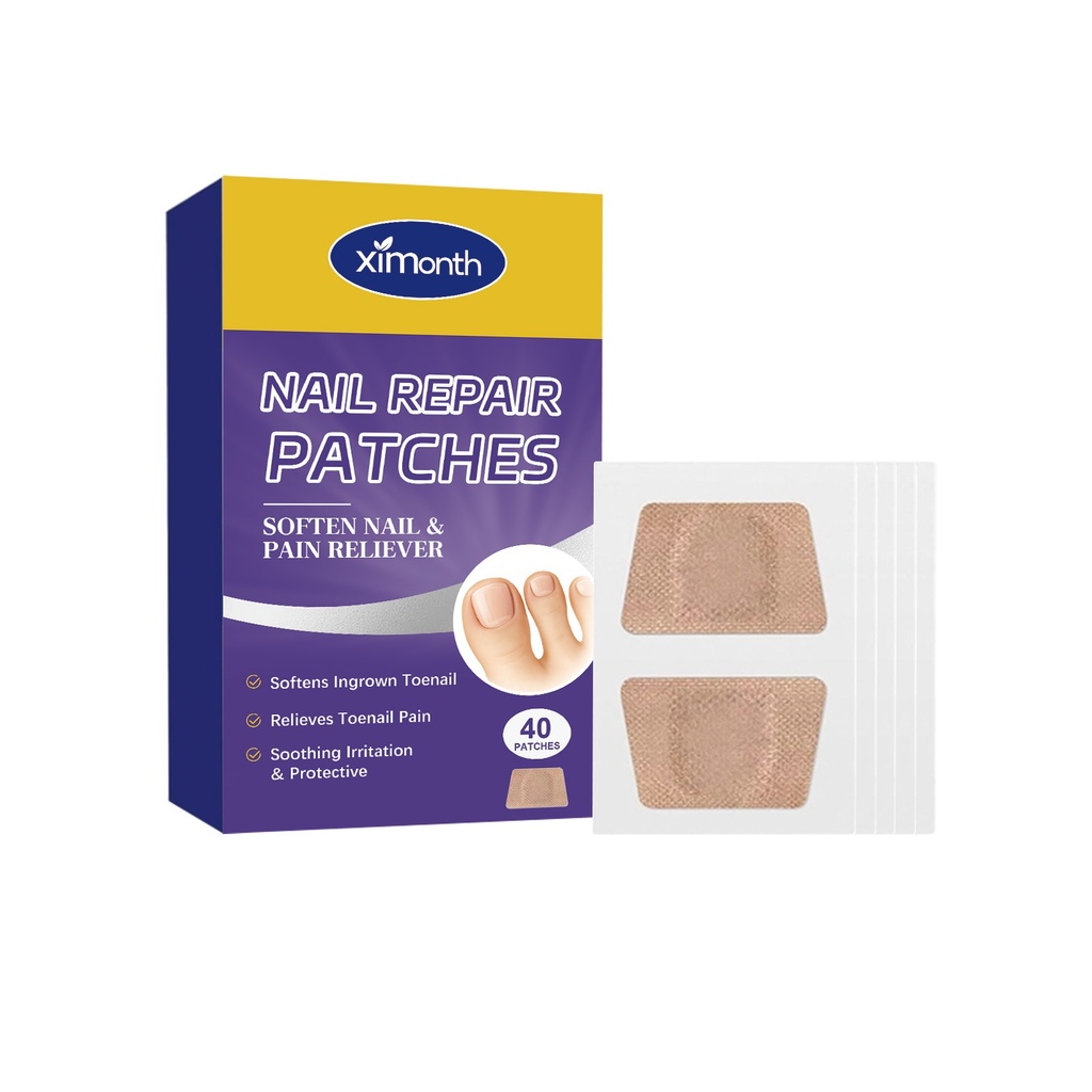 Băng dán chăm sóc móng tay Ximonth bảo vệ nhẹ nhàng móng chân và móng tay mềm mại. Băng dán chăm sóc móng tay ban đêm hàng ngày