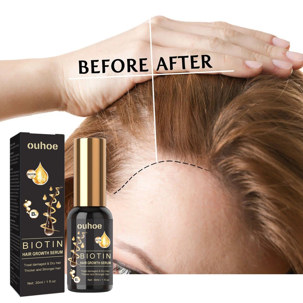 Essence Chăm Sóc Tóc Tăng Cường Biotin OUHOE, Tăng Cường Tóc, Sửa Chữa Đường Viền Tóc và Cung Cấp Độ Ẩm Cho Căn Tóc và Làm Dày Essence Tóc