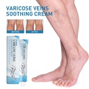 Kem Sửa Chữa Tĩnh Mạch OUHOE, Massage Giảm Đau Chân, Kem Điều Trị Varicose Veins