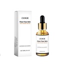 Serum chống đốm gây mất thẩm mỹ OUHOE, tinh chất làm sáng và cấp ẩm cho da.