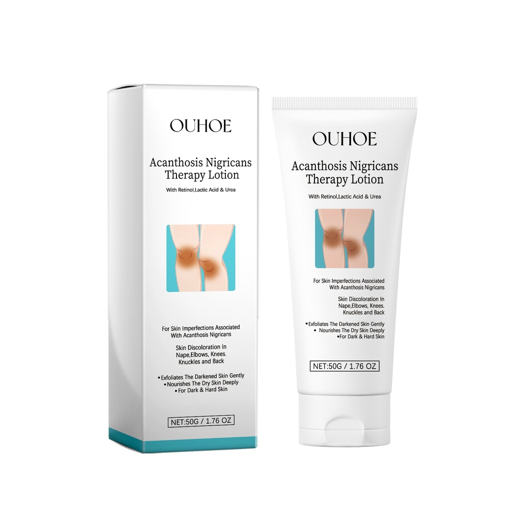 OUHOE Lotion Chữa Bệnh Acanthosis Nigricans, Dưỡng Ẩm Da, Sửa Chữa Khớp Gối Đen Tối Nặng, Mang Đến Màu Da Sáng