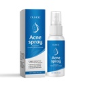 Xịt giảm dị ứng thảo dược OUHOE cho khó chịu trên mặt, Essence thảo dược giữ ẩm và làm dịu da