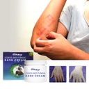 Kem Chống Nấm Aati 3 Ngày South Moon, Sửa Chữa Rào Chắn Da, Xoa Dịu Đỏ Da Rêu và Ngứa, Dưỡng Ẩm Chăm Sóc Da