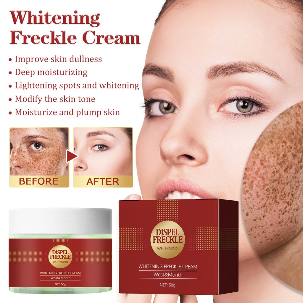 Kem làm trắng tàn nhang West&Month, phục hồi làn da xỉn màu và giảm các đốm tối và nếp nhăn