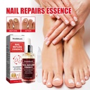 Essence Tái Tạo Móng Tay West&Month, Sửa Chữa Móng Tay Xám, Móng Tay Sáng, Móng Tay Mềm, Giải Pháp Chăm Sóc Móng Tay Sạch