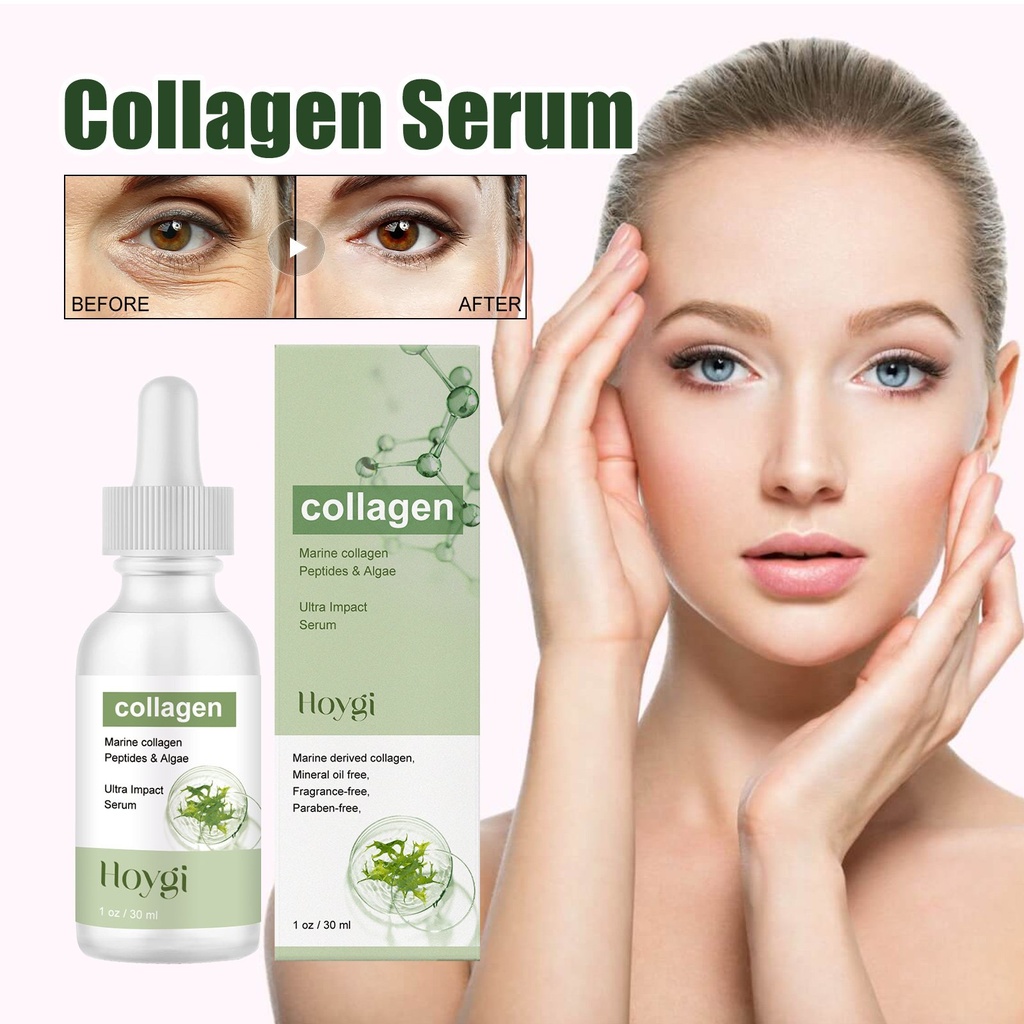 Serum Collagen Hoygi, Giảm Nhẹ Các Đường Nếp Nhăn, Cung Cấp Độ Ẩm, Săn Chắc và Chống Nhăn.