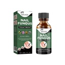 Dung Dịch Chăm Sóc Móng EELHOE (30ml) Làm Sạch Nhẹ Nhàng, Cung Cấp Độ Ẩm và Dưỡng Ẩm Cho Móng Dày và Mềm Trên Bề Mặt Tay và Chân