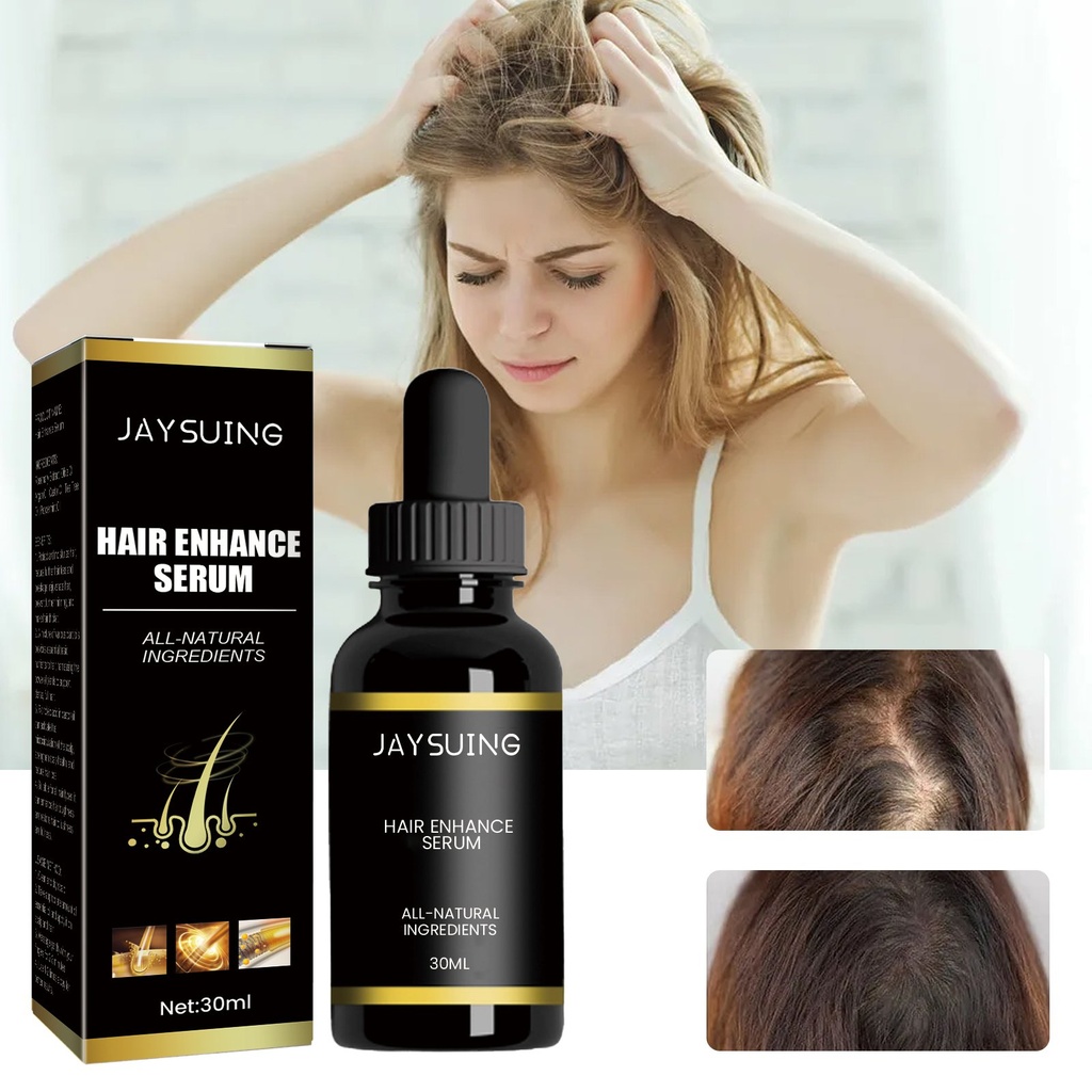 Dầu Gội Dày Rosemary Jaysuing, Ngăn Ngừa Rụng Tóc và Dầu Xoa Bóp Da Đầu Nâng Cao Giải Pháp Tóc Đầy