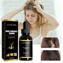 Dầu Gội Dày Rosemary Jaysuing, Ngăn Ngừa Rụng Tóc và Dầu Xoa Bóp Da Đầu Nâng Cao Giải Pháp Tóc Đầy