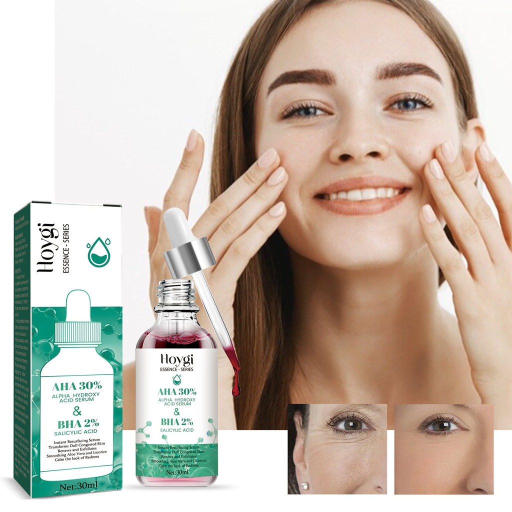 Tinh chất axit trái cây Hoygi, làm sáng vết thâm mụn, làm sạch lỗ chân lông, làm sáng da, chăm sóc nhẹ nhàng.