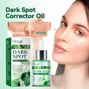 Serum Sửa Chữa Vết Nám Hoygi Làm Sáng Các Vết Thâm Trên Mặt, Vết Nám, Làm Sáng Khớp Khuỷu Tay, Làm Mềm Da Và Đồng Nhất Độ