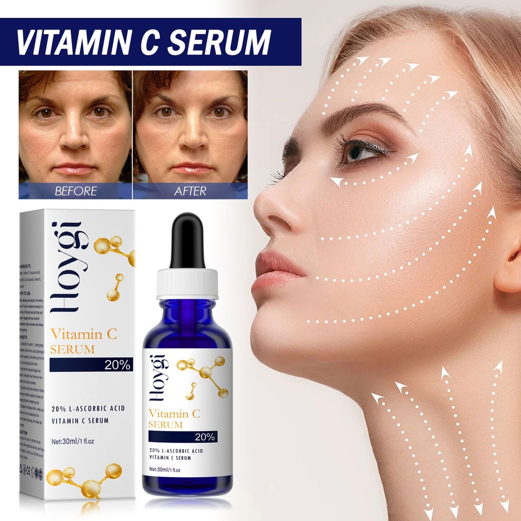 Tinh chất vitamin C Hoygi tăng cường và chống lão hóa se khít da và làm sáng mịn da