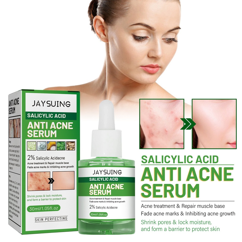 Serum chống mụn Jayusing, Làm sáng vết thâm mụn, Dưỡng ẩm cho da mặt và Phục hồi tinh chất mụn