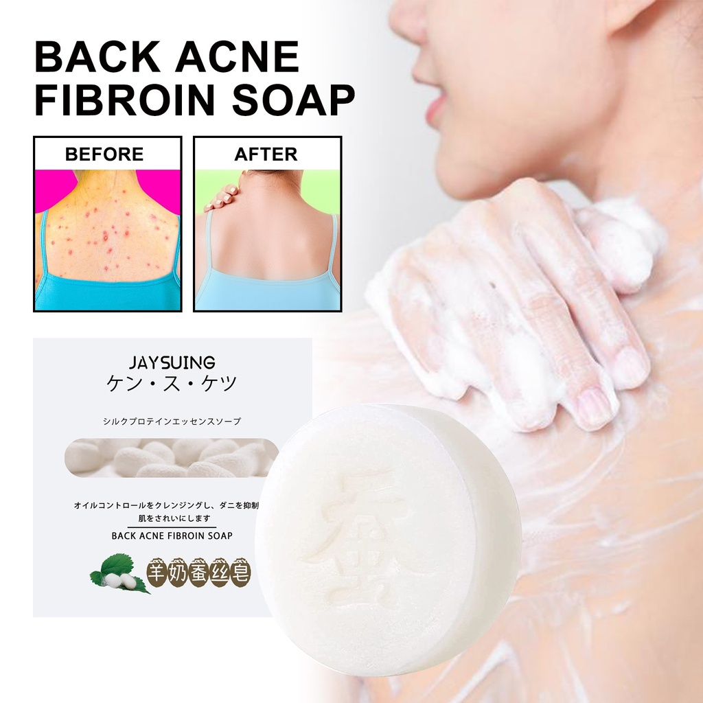 Xà phòng tơ tằm chống mụn lưng Jaysuing, dung dịch làm sạch cơ thể chống mụn và dưỡng ẩm