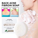 Xà phòng tơ tằm chống mụn lưng Jaysuing, dung dịch làm sạch cơ thể chống mụn và dưỡng ẩm