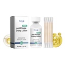 Nước Giặt Khô Chống Mụn Hoygi, Làm Sạch Mặt Và Sửa Chữa Làm Đậm Đen Các Vết Mụn, Khép Miệng Và Kem Da Nhẹ Nhàng