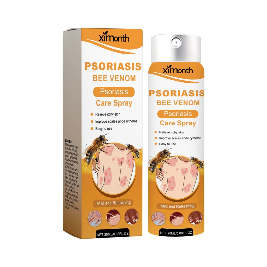 Ximonth Bình Xịt Chăm Sóc Bệnh Vảy Nến Venom Ong, Bình Xịt Thảo Dược Làm Mát Da, Giảm Ngứa, Chăm Sóc Da Chống Gàu, Bình Xịt Giảm Đỏ Nhẹ