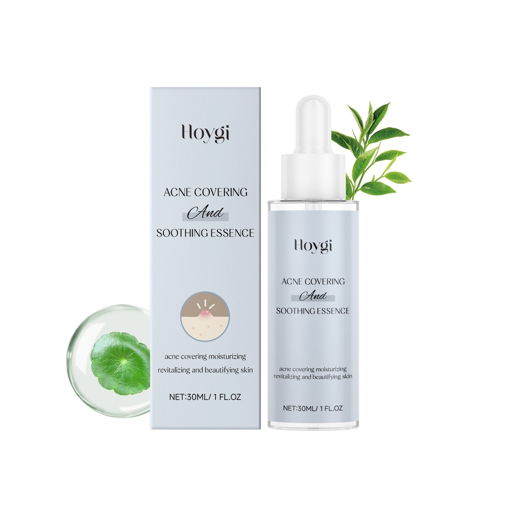 Serum làm dịu mụn Hoygi cung cấp độ ẩm và làm mềm da mặt, giải pháp chăm sóc nhẹ nhàng cho sẹo và mụn