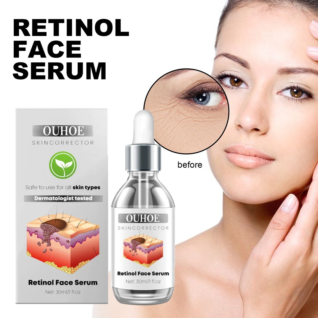 OUHOE Tinh Chất Mặt Retinol, Làm Sáng vết Thâm, Cung Cấp Độ Ẩm, Làm Chắc và Chống Nhăn