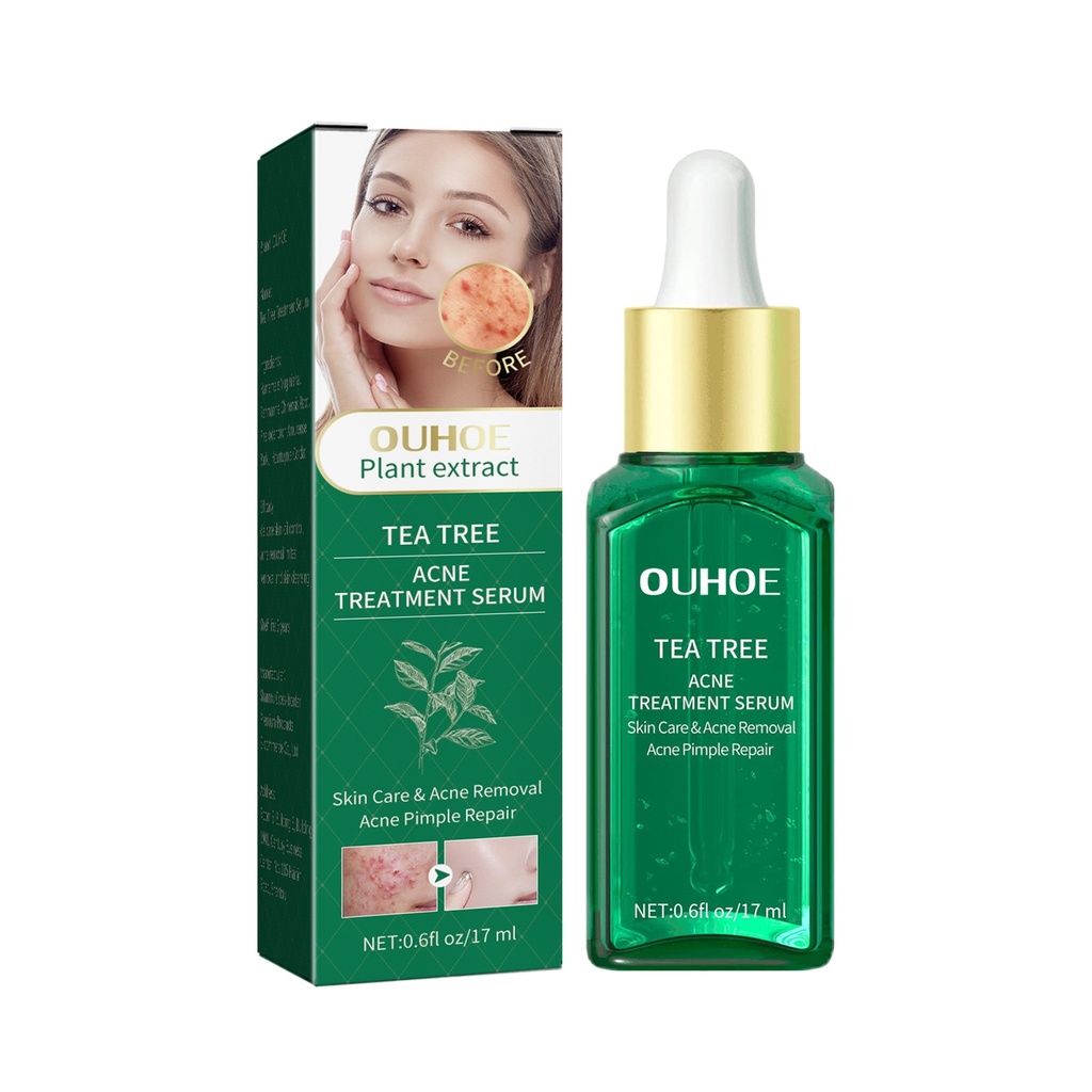 Serum Dầu Tràm Trà OUHOE, Loại Bỏ Mụn, Làm Sạch Mụn, Sửa Chữa Da, Làm Nhẹ Vết Thâm Mụn