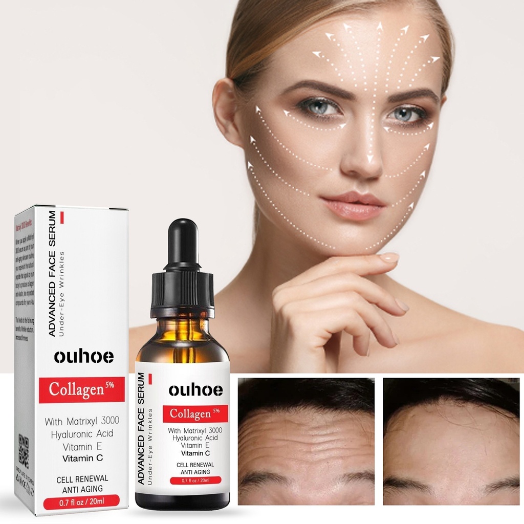 OUHOE Serum Chống Nhăn Mặt, Làm Chắc Da, Làm Sáng Nếp Nhăn Và Chống Lão Hóa, Cung Cấp Độ Ẩm