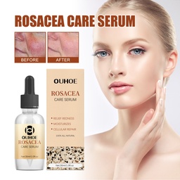 OUHOE Essence Sữa Chữa Erythematous, Phục Hồi Da Làm Sáng Da Erythematous Dầu Cần Thiết Dưỡng Ẩm