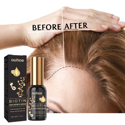 Essence Chăm Sóc Tóc Tăng Cường Biotin OUHOE, Tăng Cường Tóc, Sửa Chữa Đường Viền Tóc và Cung Cấp Độ Ẩm Cho Căn Tóc và Làm Dày Essence Tóc